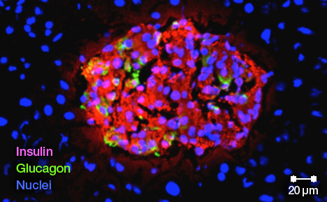 Photograph of insulin-producing human islet cells (red) regenerated through the induced pluripotent stem cell technology