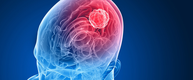Translational NeuroOncology Jann N. Sarkaria