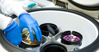 Photo of specimens in a centrifuge