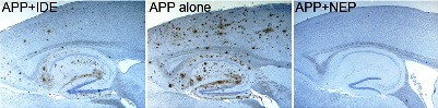 Tissue showing amyloid plaque burden