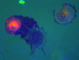 Colored image of a pancreatic tumor cell degrading matrix.