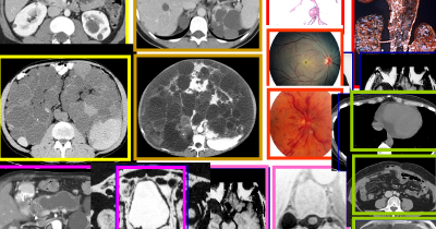 Wide spectrum of disease severity and extrarenal manifestations.