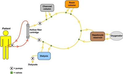 Schematic of the extracorporeal circuit of the Spheroid Reservoir Bioartificial Liver.