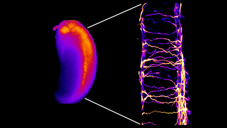 Fluorescent spinal neurons in the developing Xenopus embryo