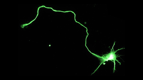 Hippocampal neuron immunostained to reveal green microtubule cytoskeleton