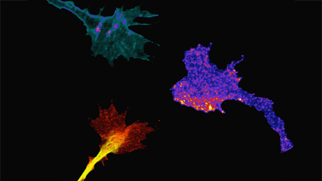 Spinal neuron growth cones