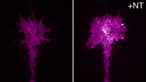 Substrate adhesions in the growth cone induced by brain derived neurotrophic factor