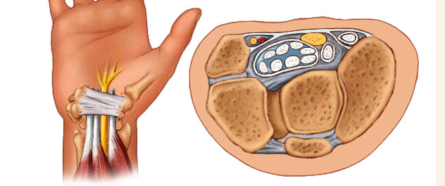 Illustration showing tendon injury in a hand