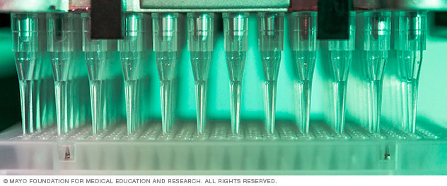 Dr. Ertekin-Taner's lab analyzes large-scale genomic, transcriptomic and epigenomic data.