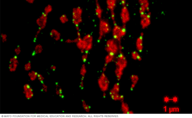A microscopy image showing dividing mitochondria in HeLa cells