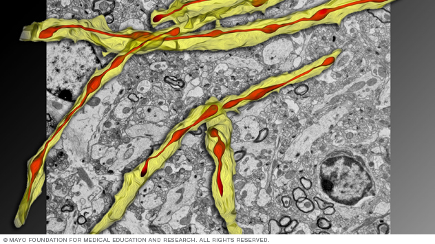 An image from Dr. Trushina's lab showing a 3D electron microscopy reconstruction of mitochondria in the hippocampus of a model of Alzheimer's disease