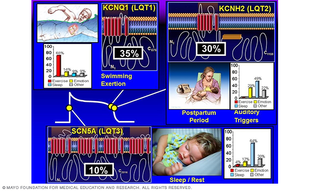 Image showing genotype-phenotype correlations in long QT syndrome
