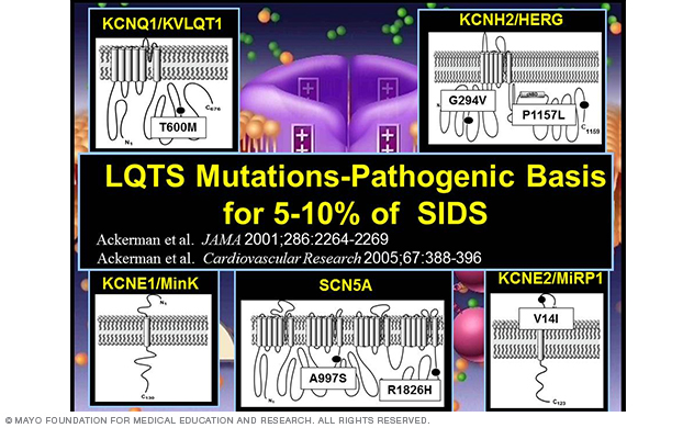 Image showing cardiac channel mutations in SIDS