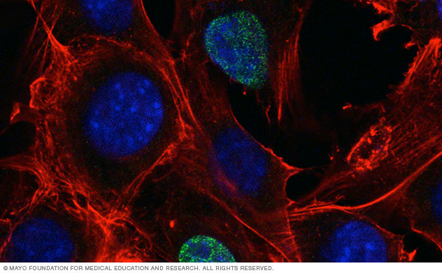 Chromosomal translocations showing Pax3-Maml3 expression in C2C12 cells and DNA depicted by different colors. Credit: Krista Bledsoe, Ph.D.