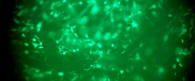Image from the Musculoskeletal Gene Therapy Research Lab showing muscle cells fluorescing green after gene transfer