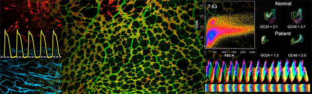 Multipaneled image demonstrating cellular defects of the gastrointestinal tract, including ion channels, electrical activity, colonic transit and gastroparesis.