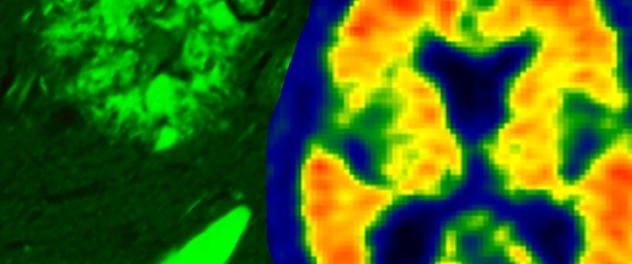 Advanced digital pathology and neuroimaging technique shown