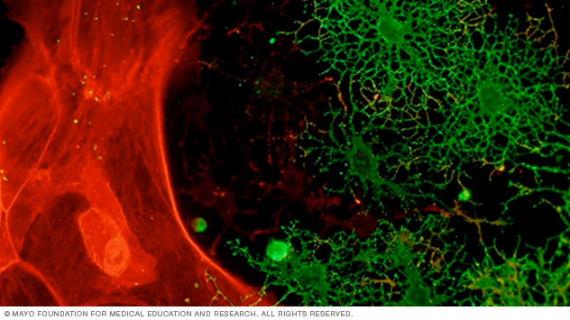 In the Neuroregeneration and Neurorehabilitation Laboratory at Mayo Clinic's campus in Minnesota, Isobel A. Scarisbrick, M.D., studies astrocytes and oligodendrocytes that control neural health, plasticity and regeneration after spinal injury.
