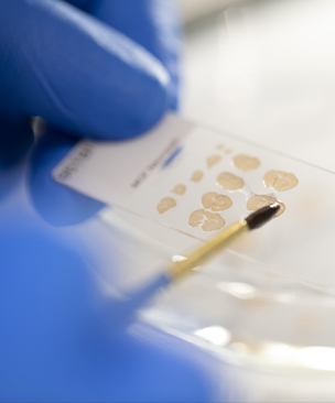 Immunostained mouse brain sections are mounted on glass slides in preparation for microscopic analyses in Mayo Clinic's Neurobiology of Parkinson's Disease Lab.
