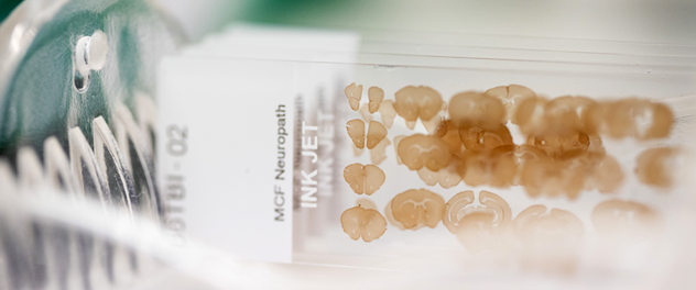 Mayo's Clinic's Neurobiology of Parkinson's Disease Lab studies mechanisms of protein aggregation in mouse models.