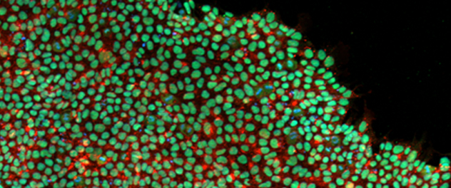 Parkinson's disease in a dish: The Neurobiology of Parkinson's Disease lab is unraveling mechanisms of neurodegenerative disease processes using human induced pluripotent stem cell models.