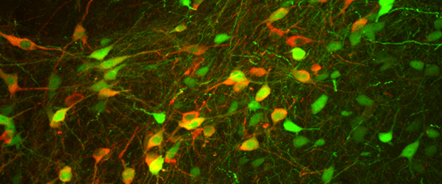 At Mayo Clinic, the McLean lab uses viral vector gene delivery to model neurodegenerative disease in rodents.