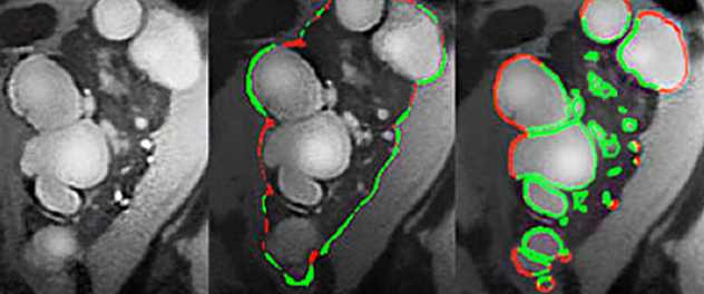 The Imaging and Analysis Core at Mayo Clinic provides PKD image analysis management services.
