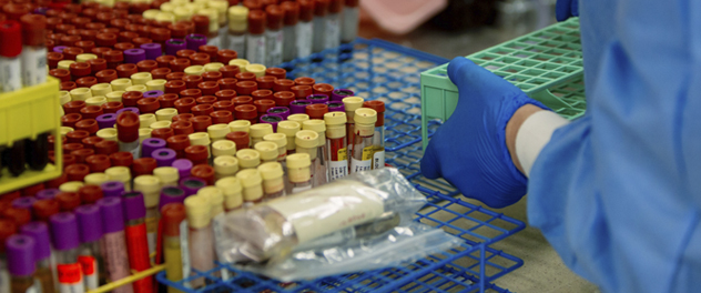 The Mayo Nephrology Collaborative Group conducts translational research on autoimmune kidney diseases.