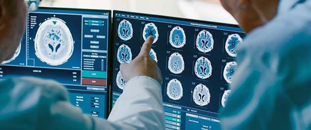 Brain scans from the Department of Neurology at Mayo Clinic focusing on movement disorders and Parkinson's disease research.