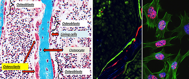 Dr. Chandra's Bone Injury and Repair Lab focuses on bone tissue regeneration by deciphering underlying cellular mechanisms and how they affect bone remodeling during various disease conditions.