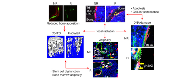 Studying radiotherapy-related bone damage as a model, Dr. Chandra is able to develop new therapeutic outcomes in his Bone Injury and Repair Lab.