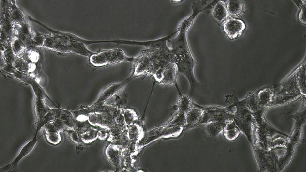 GBM neurosphere cells HSR-GBM1A (GBM1A) treated with vehicle after 48 hours (40X).
