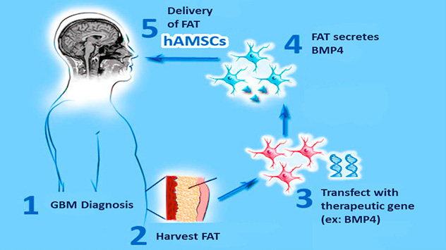 6-panel microscopy collage with boxes drawn within the panels to pinpoint cancer cells
