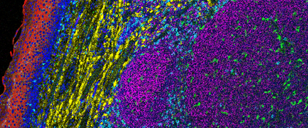 A human tonsil specimen stained to detect immune cells and structural proteins produced in the Immune Monitoring Core at Mayo Clinic by the Fluidigm Hyperion Imaging System.