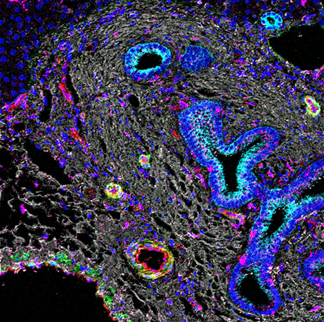 Photograph showing imaging mass cytometry of liver tissue from a patient with primary sclerosing cholangitis