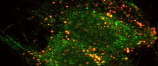 Integrin β1 trafficking in hepatocytes under lipotoxic treatment