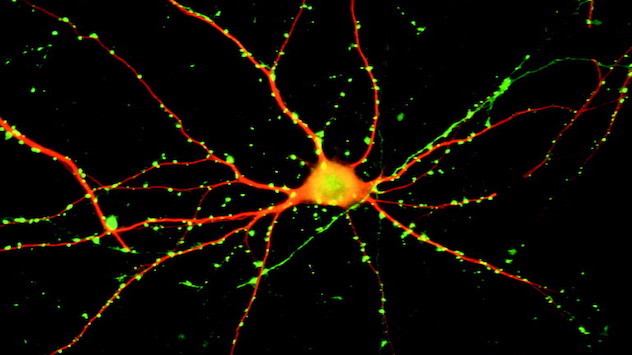 Microscopy illustrating immunofluorescent labeling of a cortical neuron in culture to visualize neuronal and synaptic morphology