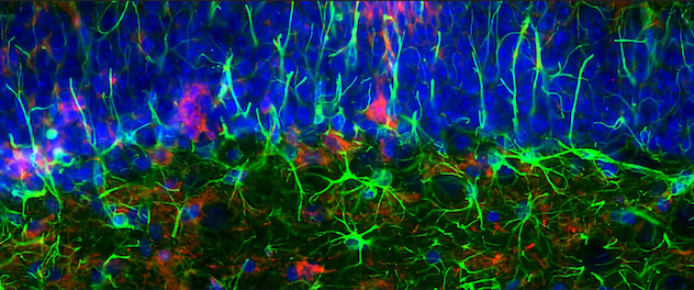 Microscopy showing hippocampal regions with astrocytes (green), pTau (red) and neurons (blue)