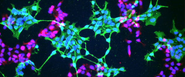 Microscopy showing human iPSC with nestin (green), PAX6 (red) and DAPI (blue)