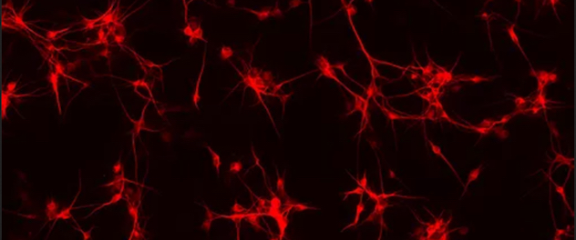 Microscopy showing primary cultured neurons (red)