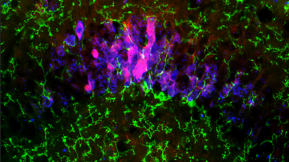 Microscopy showing microglia and pTau accumulated in neurons in hippocampal regions