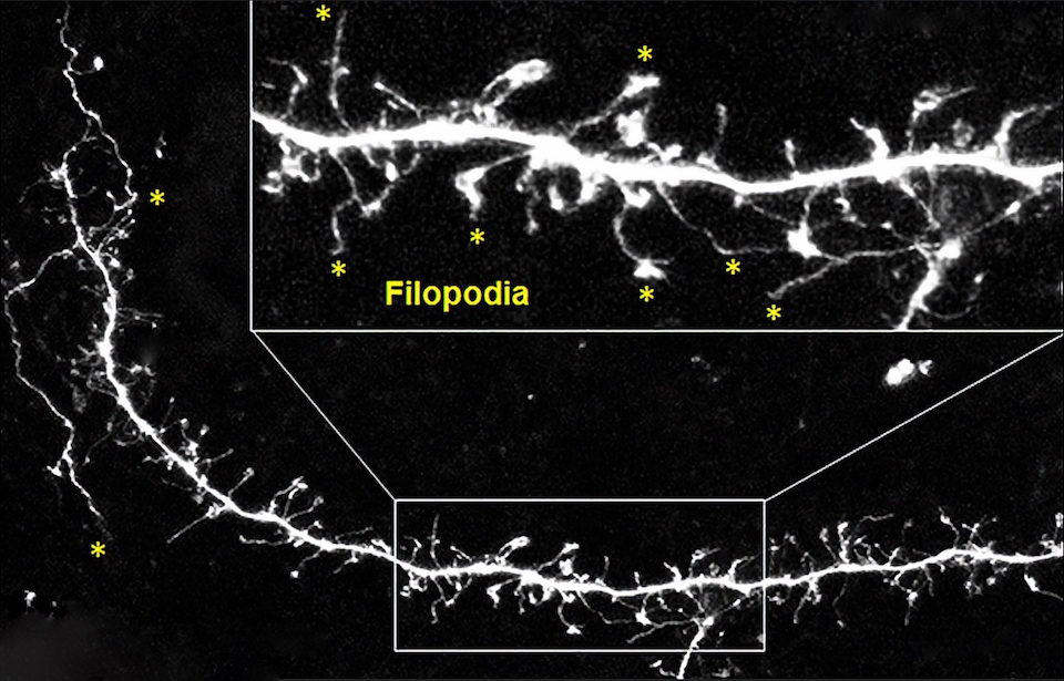 Filopodia formation