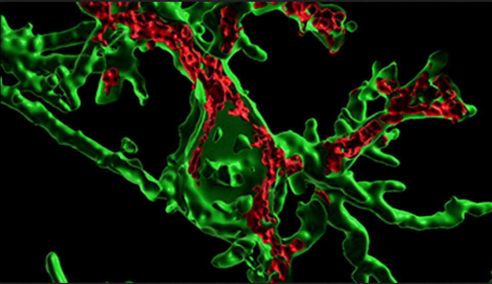 Microscopic imaging showing microglia and extracellular vesicles