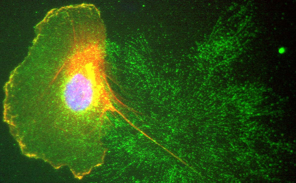 Microscopy image showing CCA cell migrating while shedding exosomes
