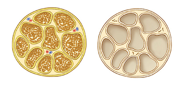 Illustration showing a nerve decellularization process