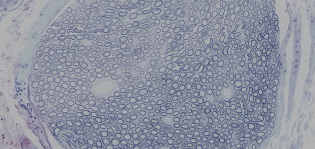 Illustration showing how staining is used to image the amount of regenerated nerves and the myelin sheath around the nerves as a measure of regeneration