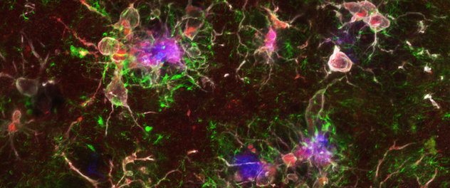 Microglia surrounding the amyloid plaques in mouse brain