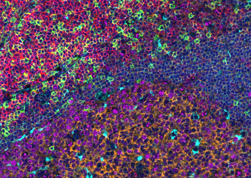 Magnified human tonsil specimen