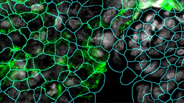 The CosMx Spatial Molecular Imaging platform defines the boundaries of cells in a triple-negative breast cancer sample. This process is called segmentation.