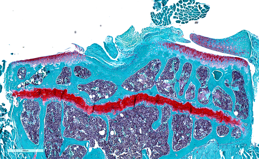 Coronal section of a mouse tibia stained with safranin O and fast green as seen in a microscopy image